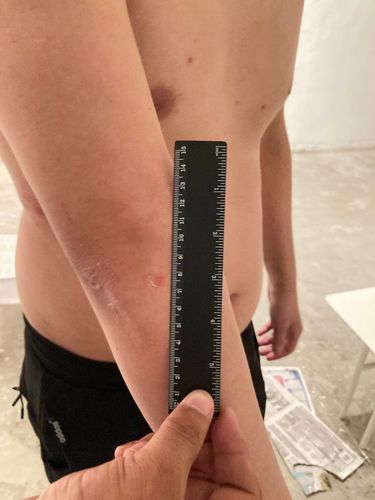 Милиция Ала-Букадагы тергөө абагындагы жарандын денесиндеги тактар боюнча маалымат берди